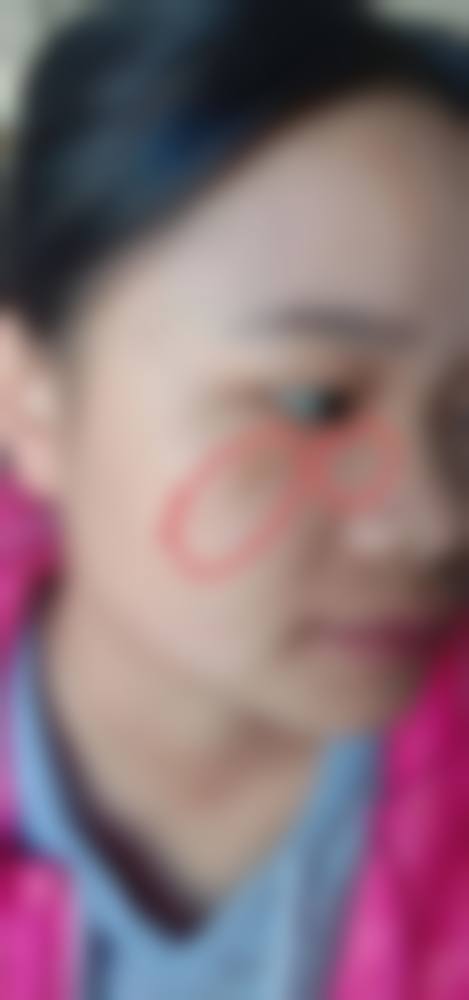 八、兰州中泰激光整形美容医院真实的顾客评价如下：