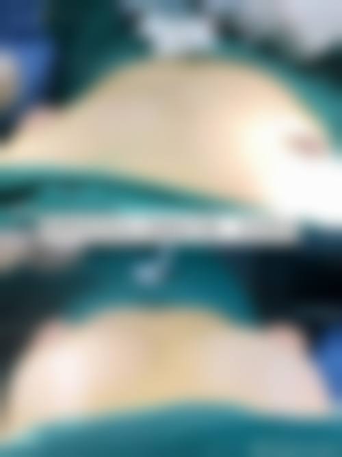 八、芜湖颜初医疗美容诊所真实的顾客评价如下：