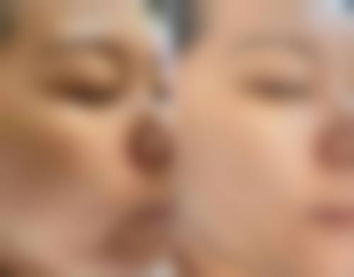 五、长沙天心罗曼丽医疗美容诊所实例