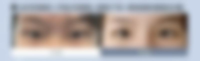 七、湘潭乔可芯医疗美容诊所真实的顾客评价如下：