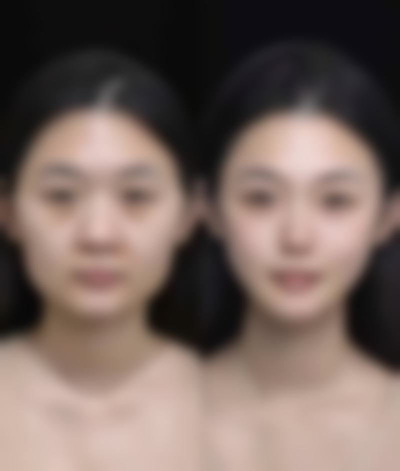 五、兰州中泰激光整形美容医院实例