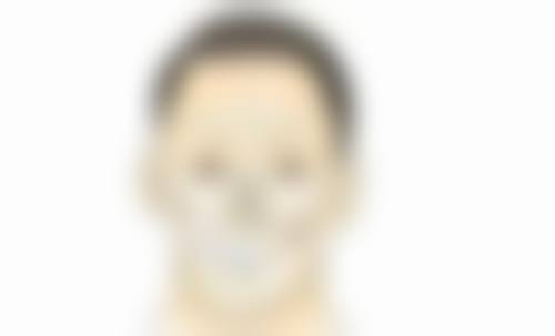 为何会出现一只双眼皮？单侧与双侧手术考量