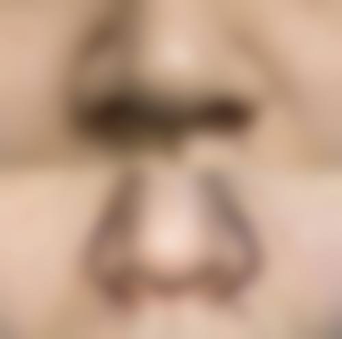 徐聪医生在哪家医院怎么预约？