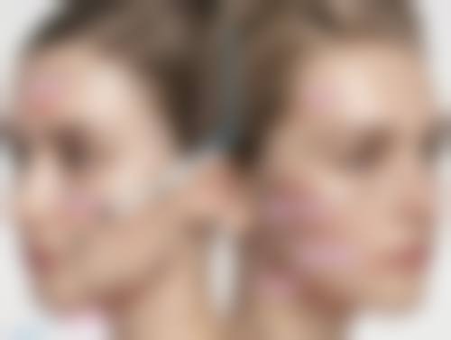 可修复的双眼皮失败类型:多种问题,一一攻克
