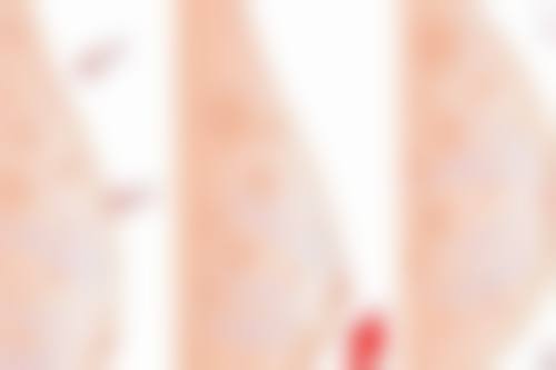 八、泉州丰泽美莱华美医疗美容真实的顾客评价如下：