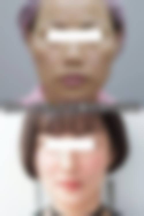 张彩萍医生怎么样可靠吗？