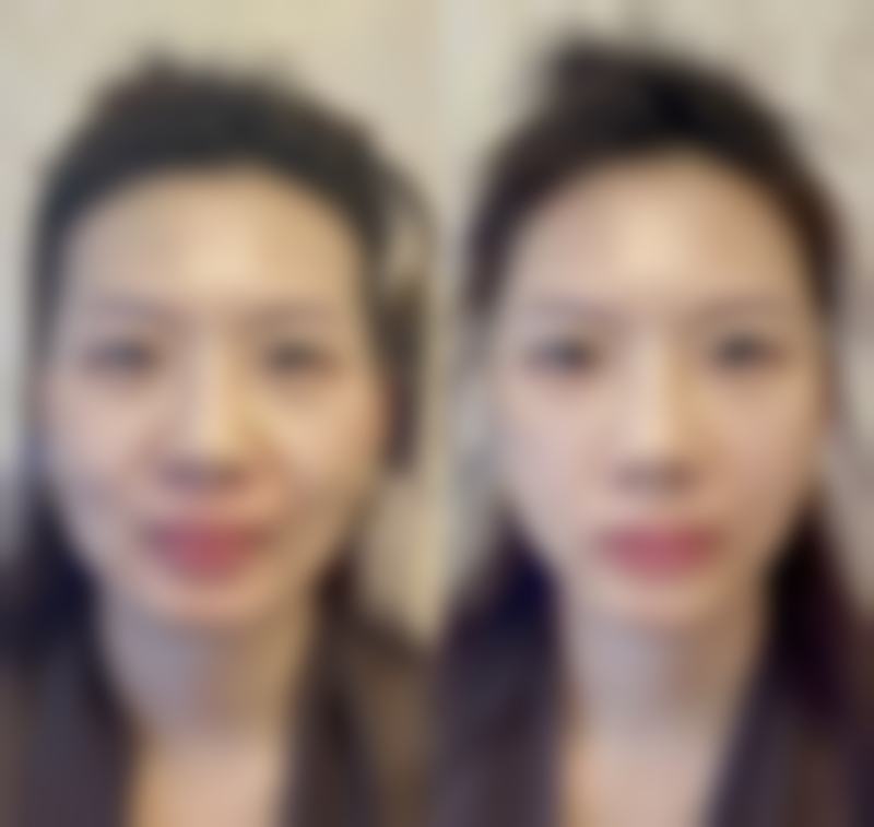 七、韩国金仁键整形美容医院价格表：（仅供参考）