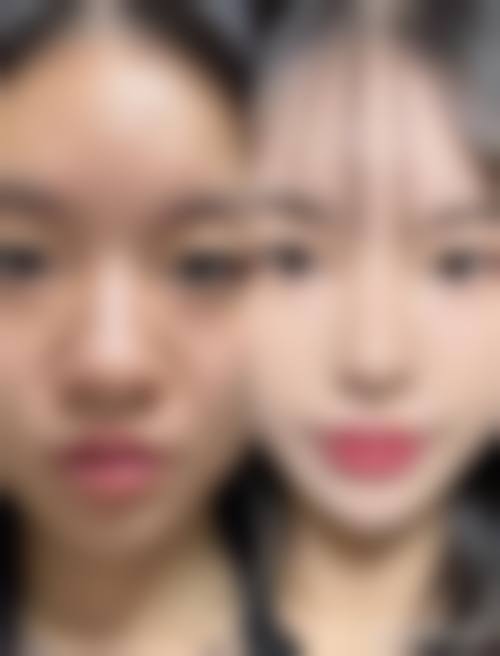 五、重庆尚莲蝶姿整形美容门诊部实例
