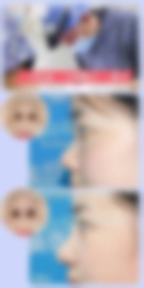 七、阳江高新区人民医院整形美容科真实的顾客评价如下：