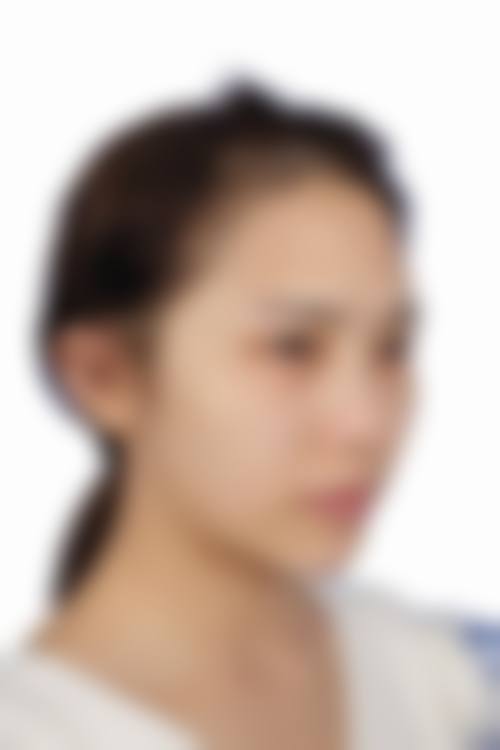 六、阳江高新区人民医院整形美容科价格表：（仅供参考）