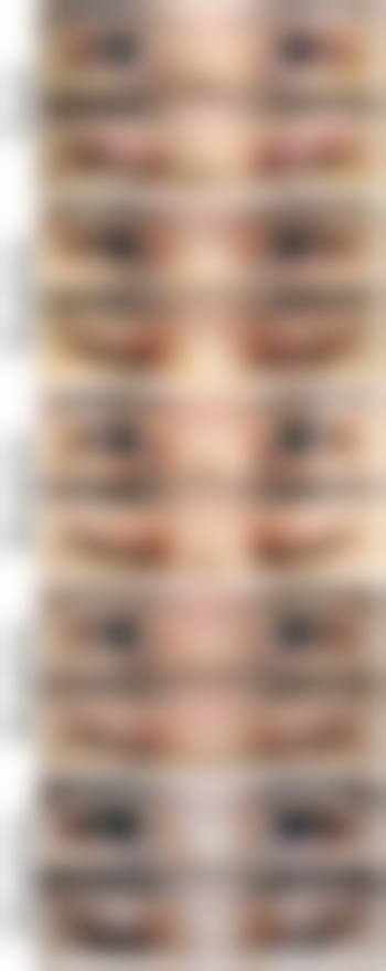 六、福州米兰医疗美容门诊部怎么预约：