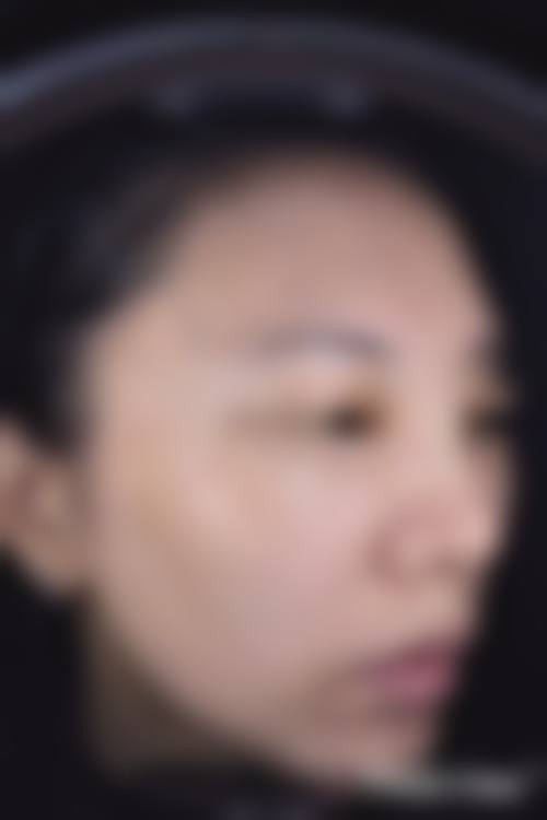 朱思瑾医生实例