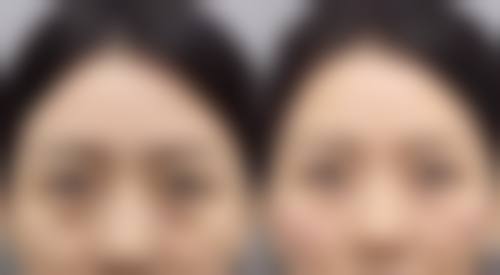 烧伤疤痕能否消除?专精机构来助力