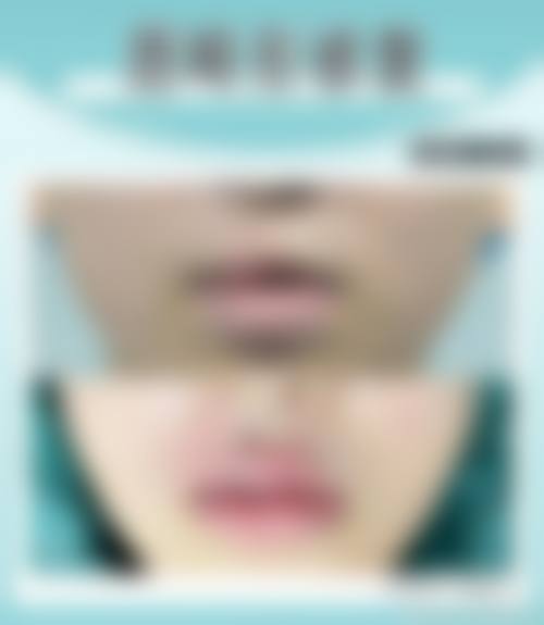 二、安徽未莱医疗美容医院正规吗？来看看医院资质：