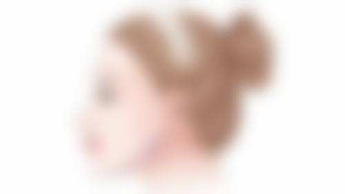 做完眼袋泪沟填充后该注意啥?日常活动限制要点揭秘