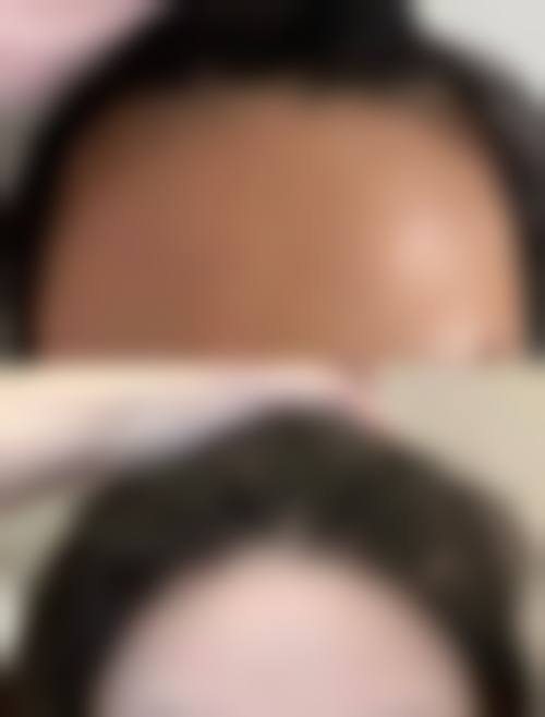 李秋雁医生怎么样可靠吗？