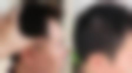 五、北京发之初雍禾植发医院怎么预约：