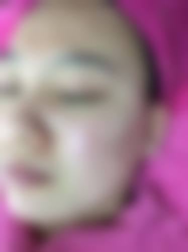 四、西安欣奕整形医疗美容诊所实例