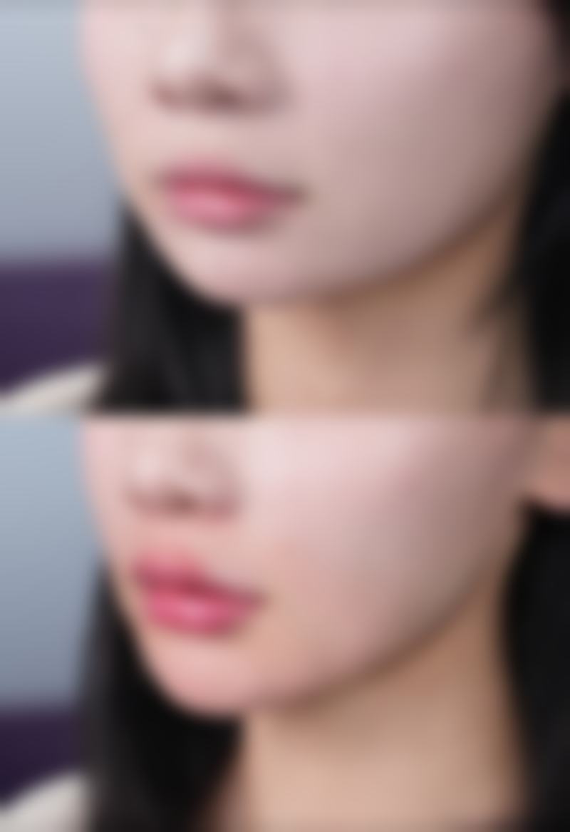 内双眼皮究竟是如何“诞生”的?皮肤与肌肉状态因素