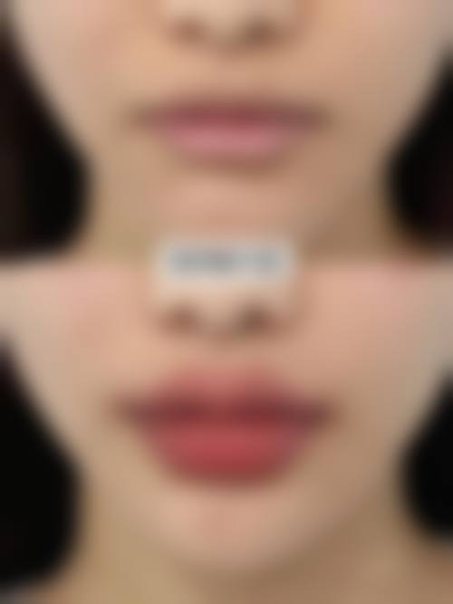 蔡小婷医生实例