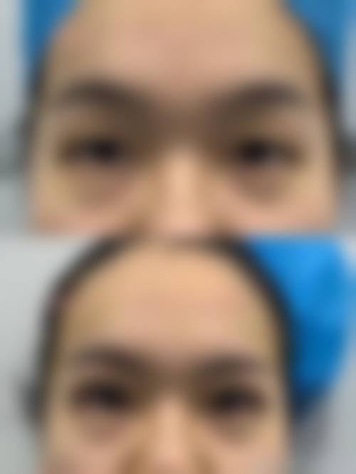蔡小婷医生项目价格表参考