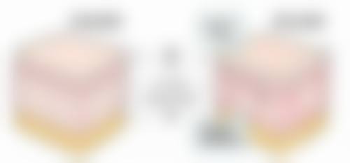 熬夜多了真会有眼袋吗?总结与建议