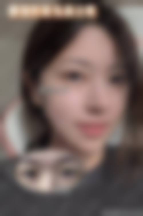 五、南宁珍善美医疗美容实例