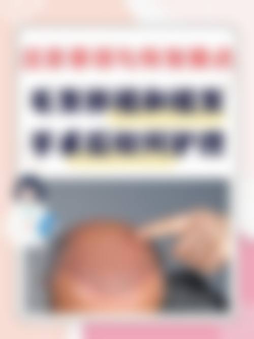 权五晟医生在哪家医院怎么预约？