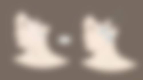 双眼皮做宽还能再做窄吗?重睑调整技术安心性有保护