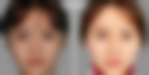 六、湖南邵阳格莱美整形医院怎么预约: