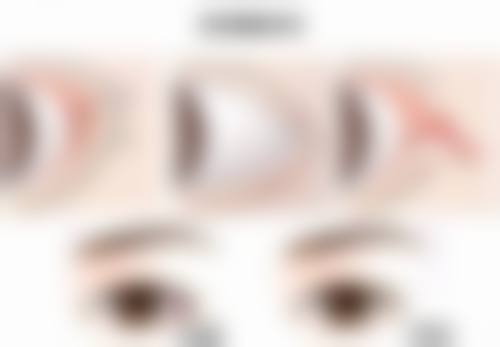 疤痕体质会随年龄改变吗?看看不同年龄段疤痕的变化