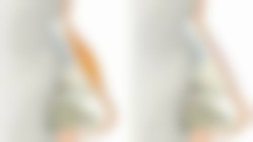 疤痕体质会随年龄改变吗？揭秘不同年龄段疤痕变化及体质差异特点 