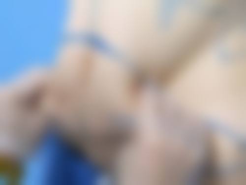 割双眼皮:开启美丽新征程