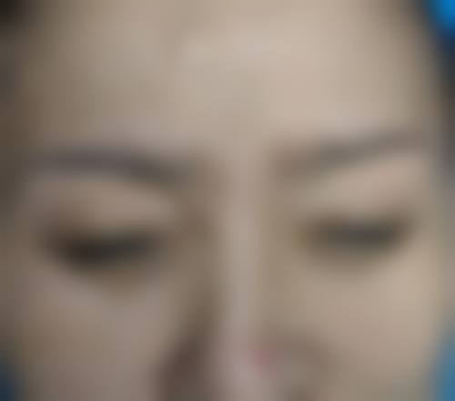 七、南宁馥颜医疗美容门诊部价格表：（仅供参考）