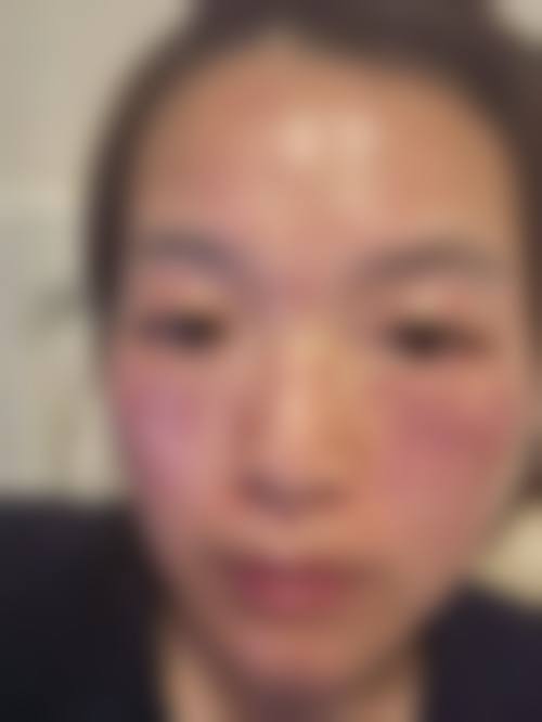 七、常州丽华医院皮肤美容科价格表:(仅供参考)