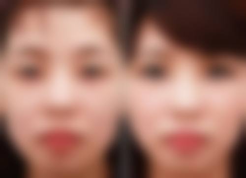 五、威海薇贝提整形医院实例