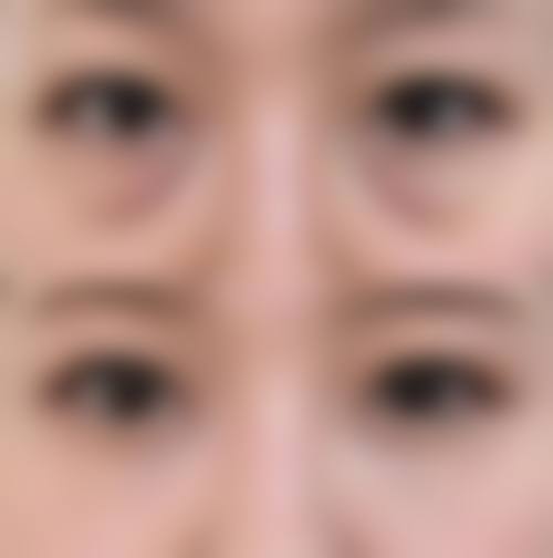 五、安康青美医疗美容实例