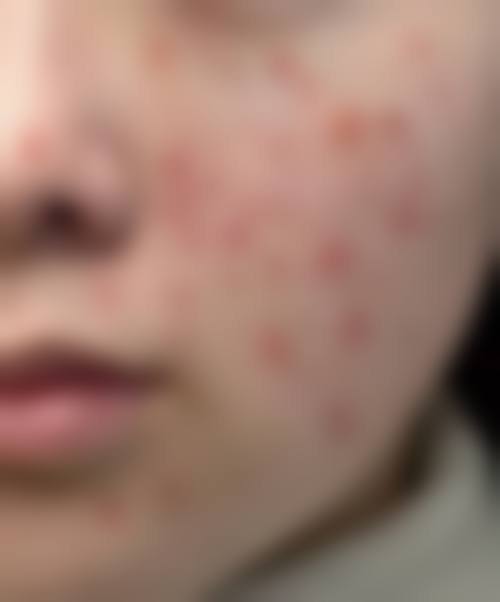 柳志燕医生在哪家医院怎么预约?
