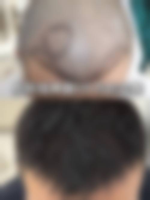 葉昱廷医生怎么样可靠吗？