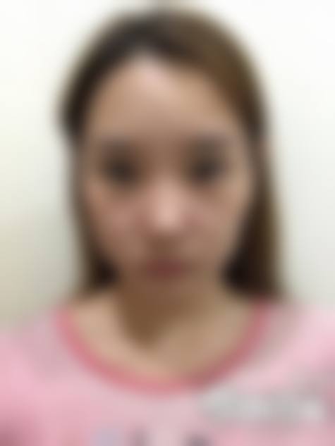 八、威海薇贝提整形医院真实的顾客评价如下: