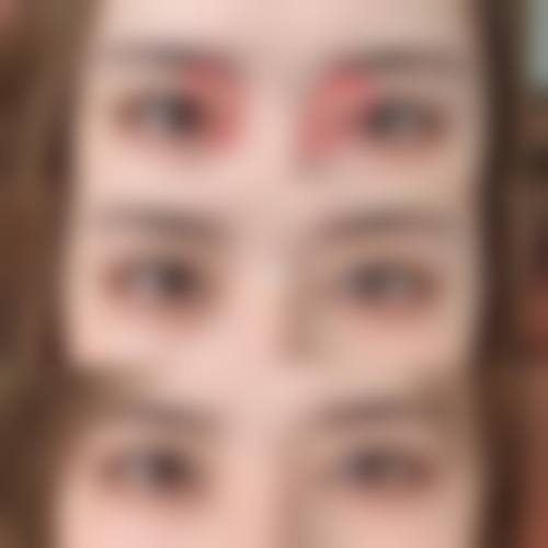 李秋雁医生在哪家医院怎么预约?