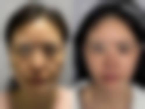 李秋雁医生口碑和评价
