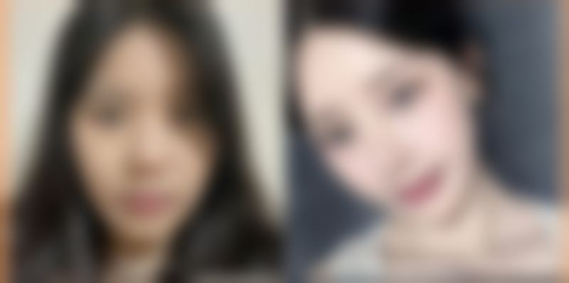 芦荟胶真能淡化疤痕吗？保湿抗炎促修复，对浅表疤痕有一定改善作用 