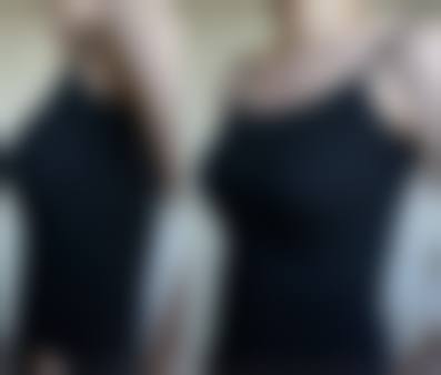 八、宁波鄞州赫美整形医院真实的顾客评价如下：