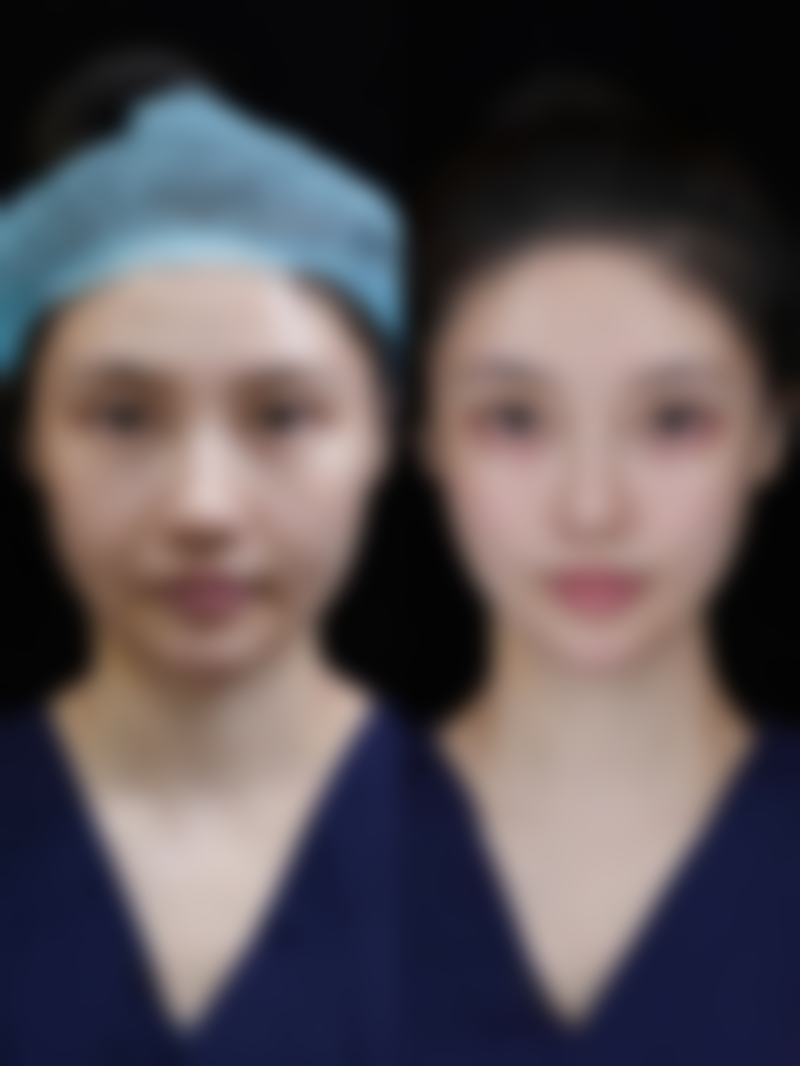 脸部烫伤疤痕去除有妙招？多种疗法+日常护理，显著淡化疤痕不是梦 