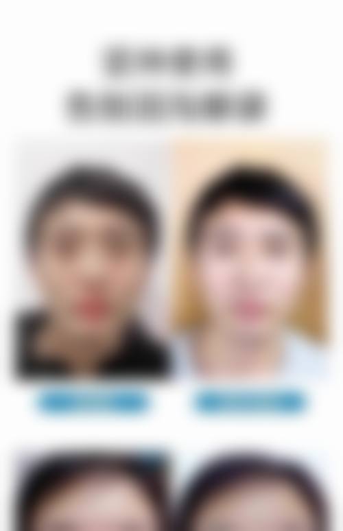 七、深圳布她一生整形医院价格表:(仅供参考)