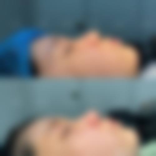 五、成都武侯伊欣颜轻整形医院实例