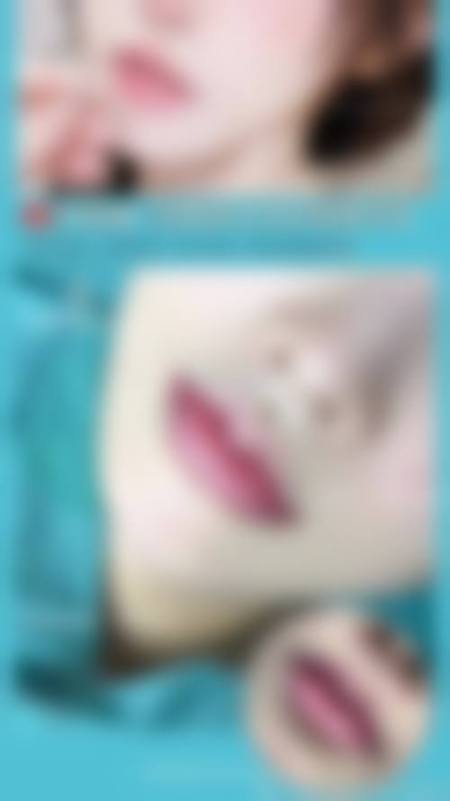 五、广东珠海鱼美人整形医疗美容实例