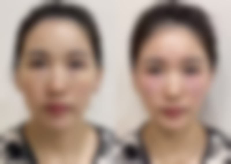 六、普洱现代整形诊所价格表:(仅供参考)