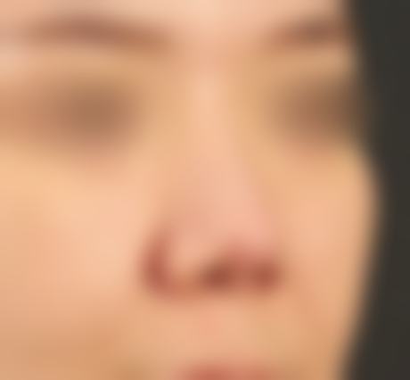 韩国TS整形医院梁涼弼医生预约面诊常见问题解答